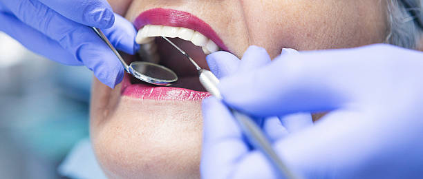 Best Emergency Root Canal Therapy in Copeland, OK